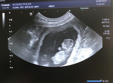 Echographie_Polka